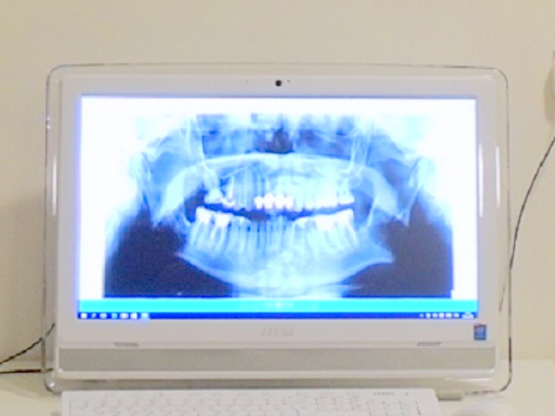 Diagnostyka RTG zębów Nowy Sącz
